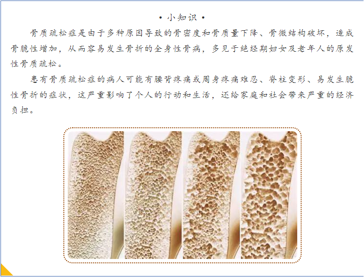 补钙要趁早，别等骨质疏松了再后悔！