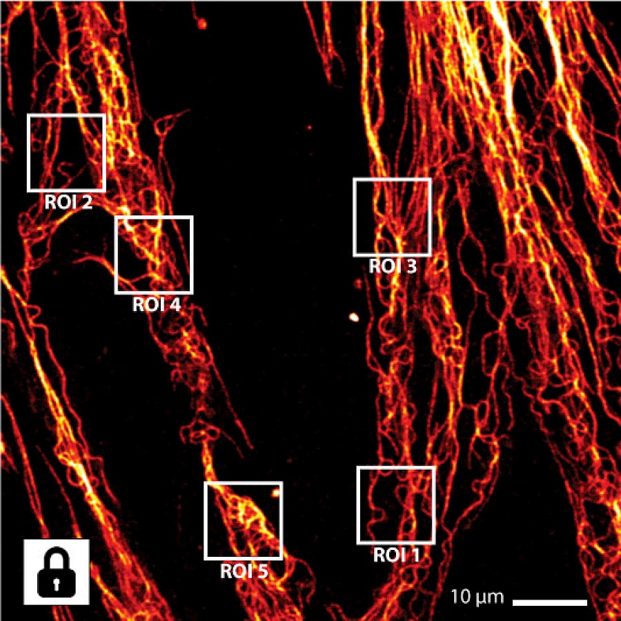 Infinity Line-STED超高分辨率显微镜