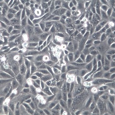 SNU-449、SNU-449细胞系、SNU-449细胞株、SNU-423人肝癌细胞[STR]