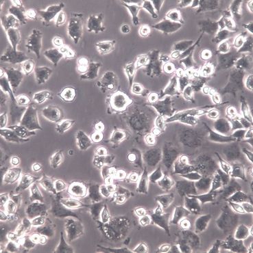 DH82、DH82细胞系、DH82细胞株、DH82狗肾恶性组织细胞增生症细胞