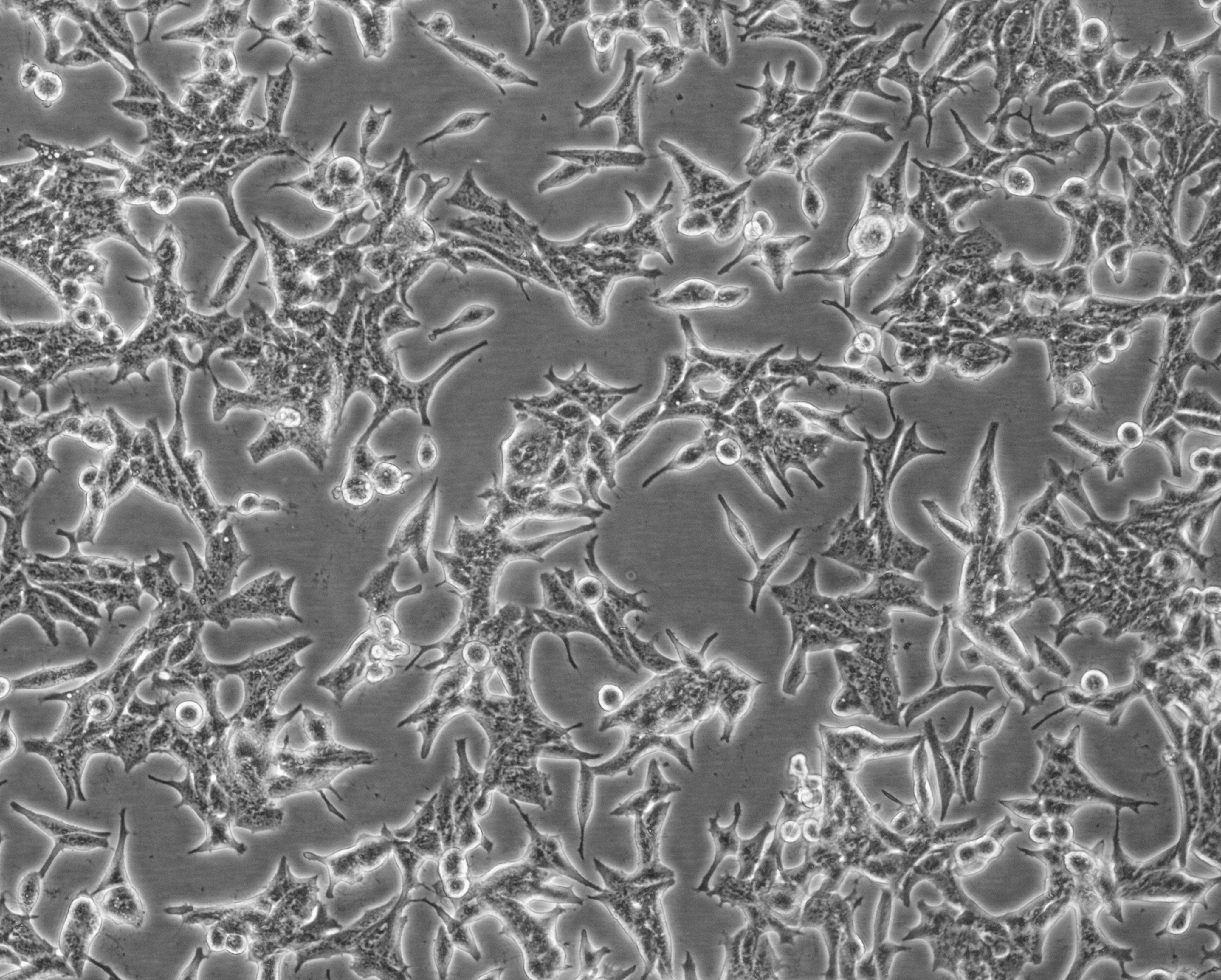 细胞攻略 | C4-2(人前列腺癌细胞)细胞培养教程