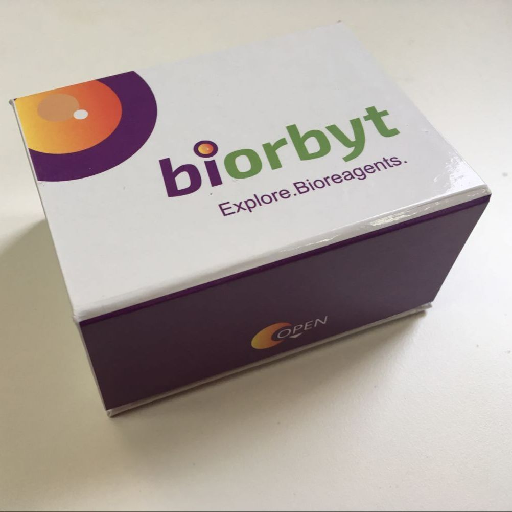 Human Interleukin 10 (IL-10) ELISA Kit试剂盒,orb1670411,Biorbyt