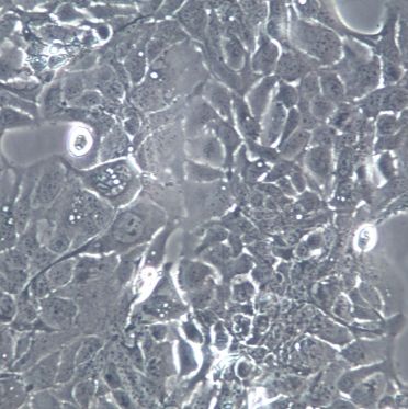 HT-1376人膀胱癌细胞[STR]
