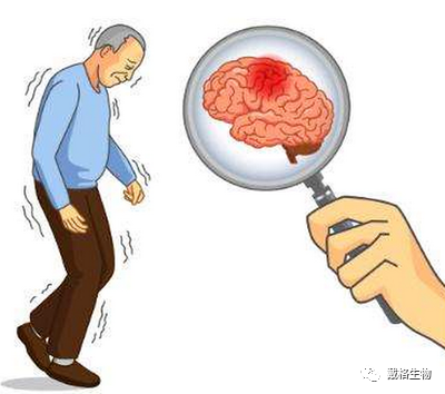 神经退行性疾病——帕金森症