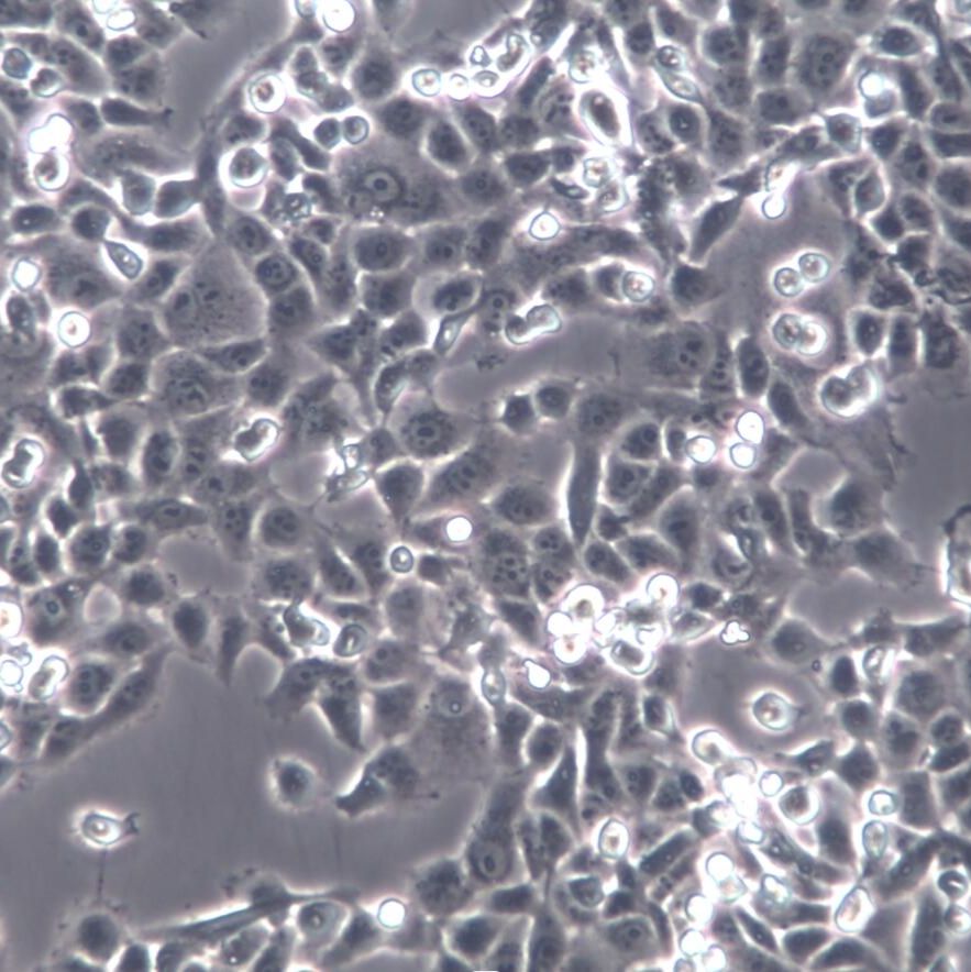 IOMM-Lee、IOMM-Lee细胞系、IOMM-Lee细胞株、IOMM-Lee人脑膜瘤细胞[STR]