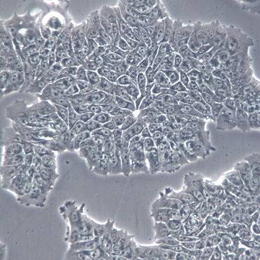 【RT4】RT4细胞/RT4细胞/RT4人膀胱移行细胞乳头瘤