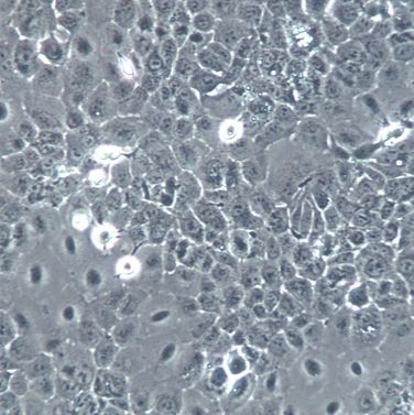 【NCI-H292】NCI-H292细胞/NCI-H292细胞/NCI-H292人肺癌细胞(淋巴结转移)