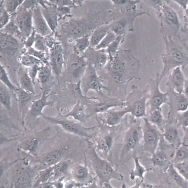 【Hs578T】Hs578T细胞/Hs578T细胞/Hs578T人乳腺癌细胞