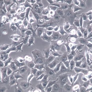 【PANC-1】PANC-1细胞/PANC-1细胞/PANC-1人胰腺癌细胞