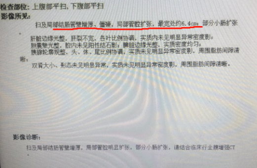 肠道里怎么会有「石头」？
