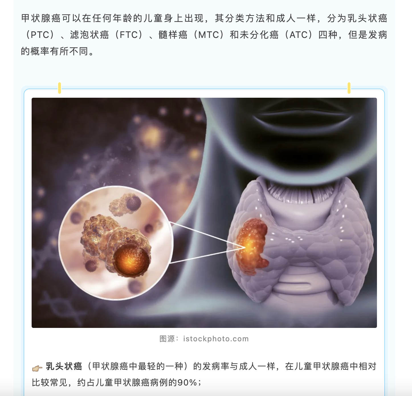 从切尔诺贝利,到儿童甲状腺癌|儿童节说