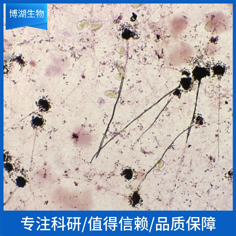 小鼠输卵管平滑肌细胞