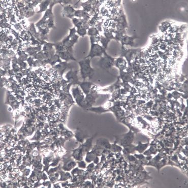 266-6、266-6细胞系、266-6细胞株、266-6小鼠胰腺腺泡癌细胞