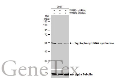 Tryptophanyl tRNA synthetase antibody [HL2186]