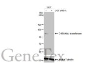 O-GlcNAc transferase antibody [HL1641]