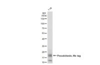 Human Procalcitonin, His tag