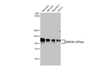 SERCA2 ATPase antibody [HL2352]