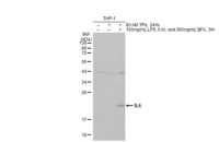IL6 antibody [HL2389]