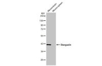 Stargazin antibody [HL2268]