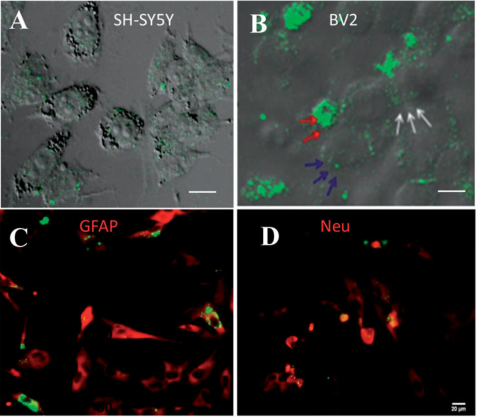强势来袭-国自然热点[外泌体研究解决方案]