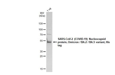 SARS-CoV-2 (COVID-19) Nucleocapsid protein, Omicron / BA.2 / BA.5 variant, His tag