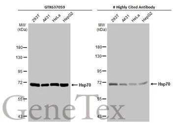 Hsp70 antibody [HL1580]