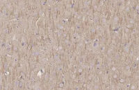 MAP2 antibody [HL1656]