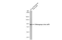 Chikungunya virus nsP2 antibody [HL1488]