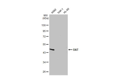 OAT antibody [HL2087]