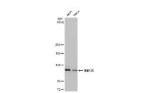 RNF31 antibody [HL2295]