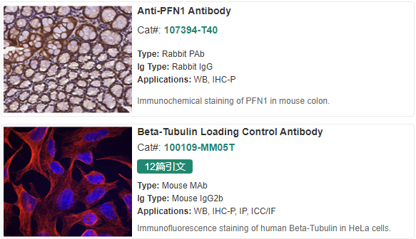 头颈部癌的新兴生物标志物：Osteonectin、S100A9、FGFR1等