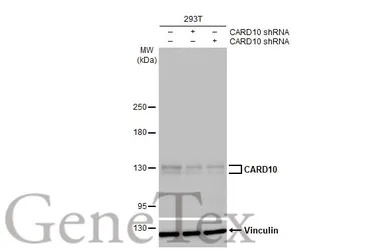 CARD10 antibody [HL2260]