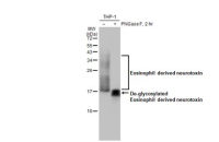Eosinophil derived neurotoxin antibody [HL2166]