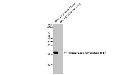 Human Papillomavirus type 16 E7 antibody [HL1821]