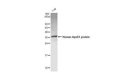 Human ApoE4 protein