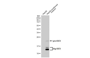 IGF2 antibody [HL1982]