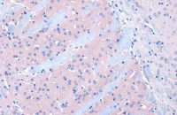 Dopamine Receptor D2 antibody [HL1584]