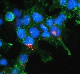 强势来袭-国自然热点[外泌体研究解决方案]