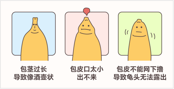 孩子啥时候割包皮，注意事项有哪些？