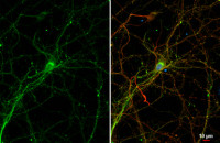 Bassoon antibody [HL1732]
