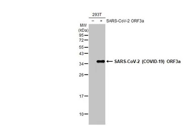 SARS-CoV-2 (COVID-19) ORF3a antibody [HL1722]