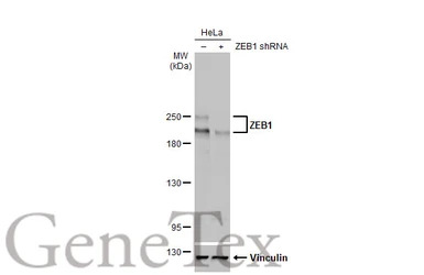 ZEB1 antibody [HL2245]