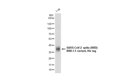 SARS-CoV-2 (COVID-19) Spike RBD Protein, Omicron / XBB.1.5 variant, His tag
