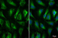 ZC3HAV1 antibody [HL1884]
