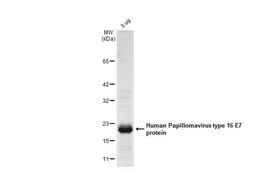 Human Papillomavirus type 16 E7 protein, His tag