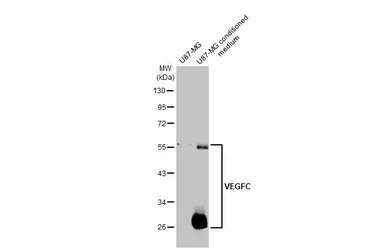 VEGFC antibody [HL2289]
