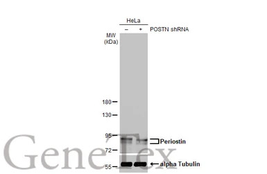 Periostin antibody [HL2112]