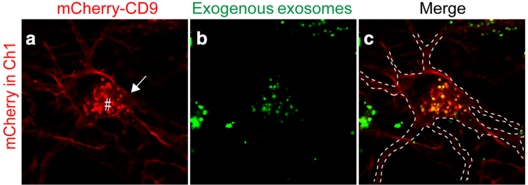 强势来袭-国自然热点[外泌体研究解决方案]