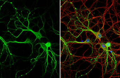 MAP2 antibody [HL1655]