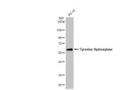 Tyrosine Hydroxylase antibody [HL1762]